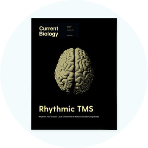 Book cover with a brain illustration on a black background